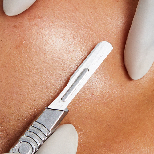dermaplaning detail_1